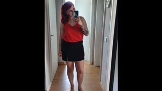 Katharina Mayer aus Gummersbach zeigt ihre Füße